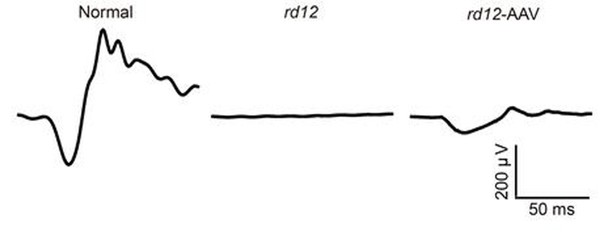 망막전위도 검사 결과, 시각반응이 거의 없던 rd12생쥐(가운데)에 비해 치료 받은 rd12-AAV 생쥐(오른쪽)는 시각반응이 조금씩 회복됐다. 왼쪽은 정상 생쥐의 시각반응